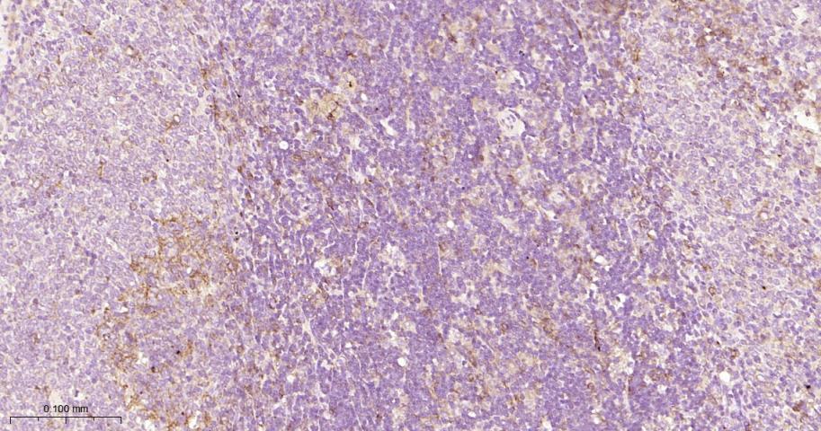 基质金属蛋白酶-14重组兔单抗