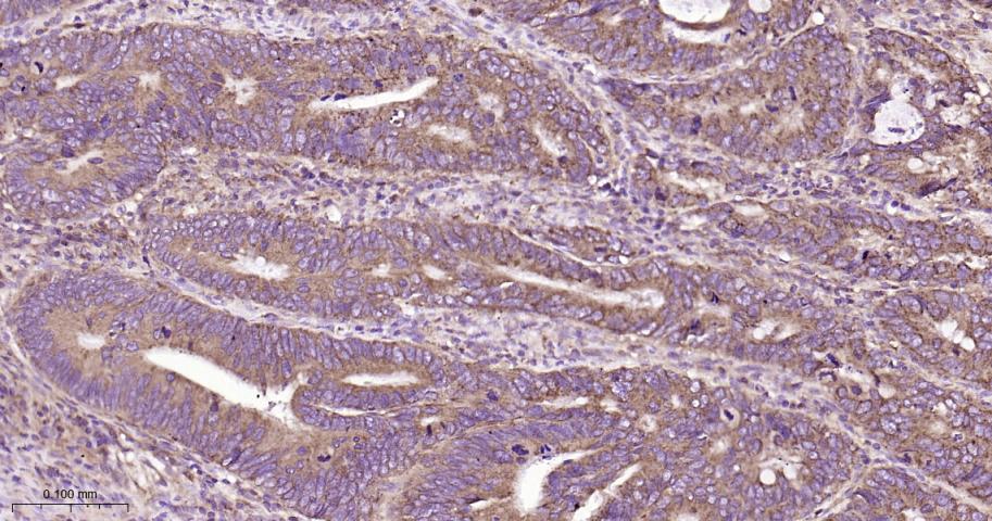 基质金属蛋白酶-14重组兔单抗