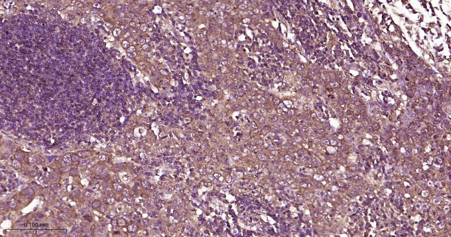 磷酸化雷帕霉素靶蛋白重组兔单抗