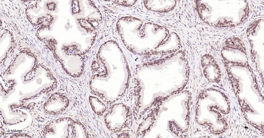 环指蛋白75重组兔单抗