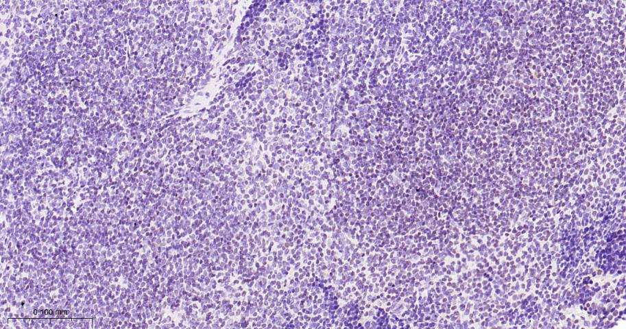 干扰素调节因子2重组兔单抗