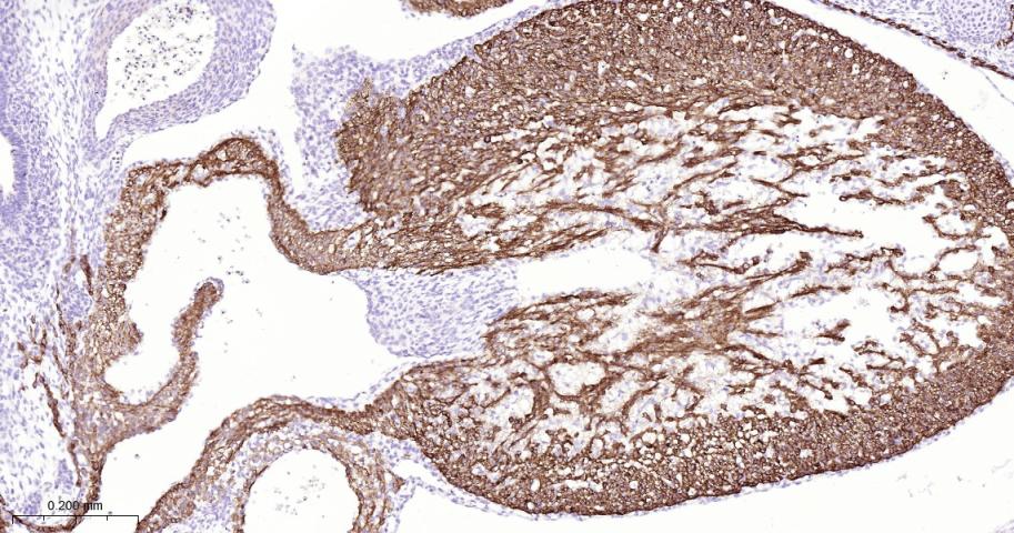 心肌肌钙蛋白重组兔单抗