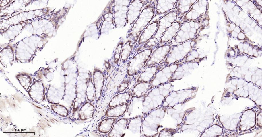 环指蛋白75重组兔单抗