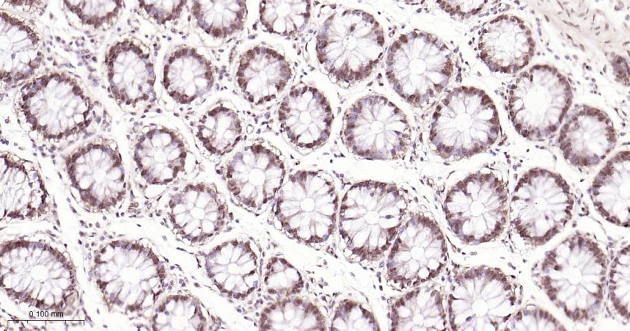 环指蛋白75重组兔单抗
