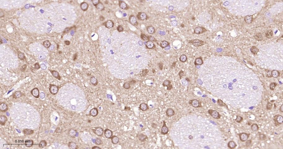 丝裂原活化蛋白激酶激酶1/2重组兔单抗