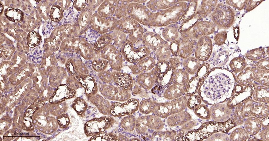 磷酸化雷帕霉素靶蛋白重组兔单抗