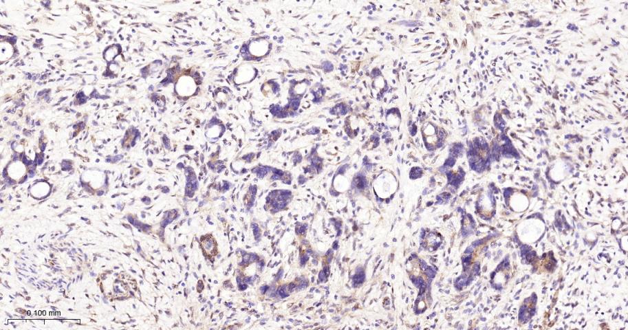 磷酸化蛋白激酶A α/β/γ重组兔单抗