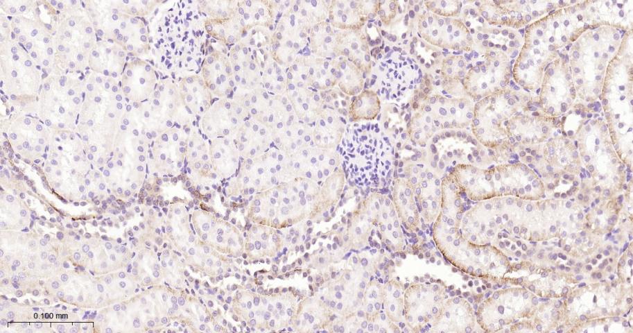 磷酸化蛋白激酶A α/β/γ重组兔单抗