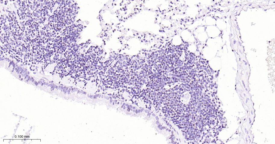 干扰素调节因子2重组兔单抗