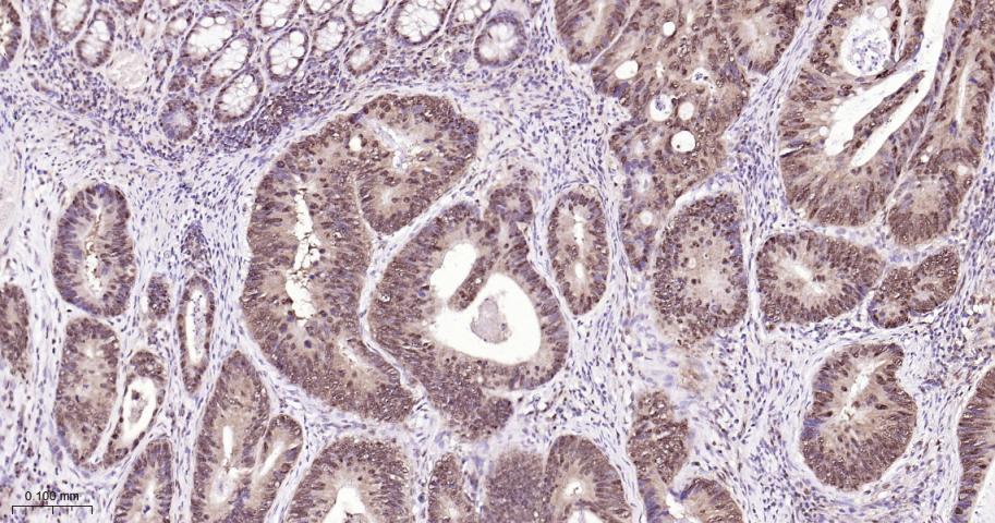 环指蛋白75重组兔单抗
