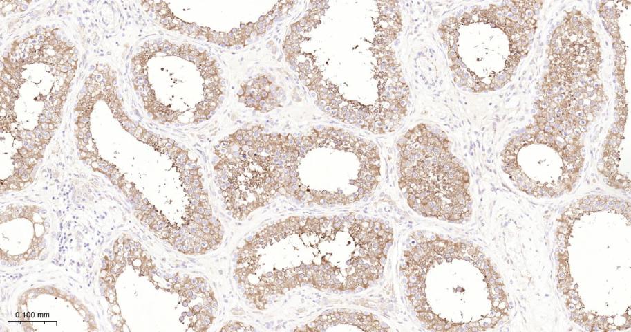 磷酸化蛋白激酶A α/β/γ重组兔单抗