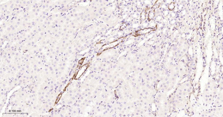 磷酸化蛋白激酶A α/β/γ重组兔单抗