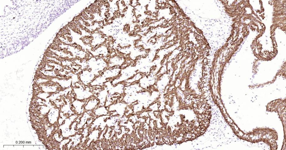心肌肌钙蛋白重组兔单抗