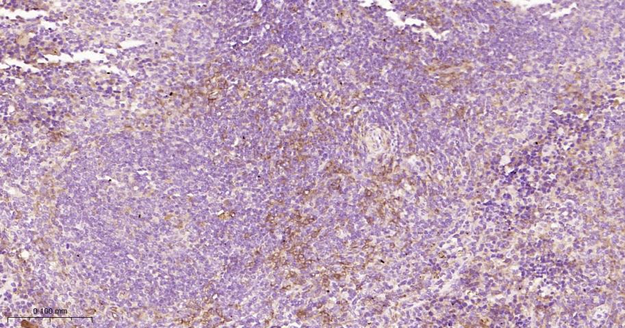 基质金属蛋白酶-14重组兔单抗