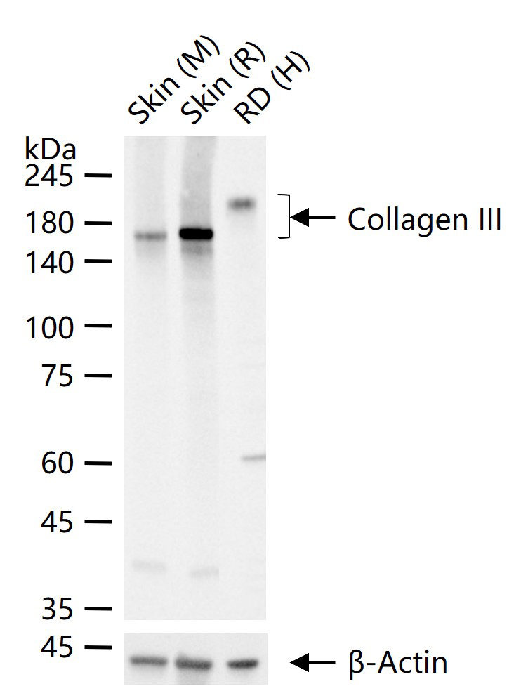 Collagen III Rabbit pAb (一抗) - WB,IHC-P,IHC-F,IF,ICC/IF | Bioss