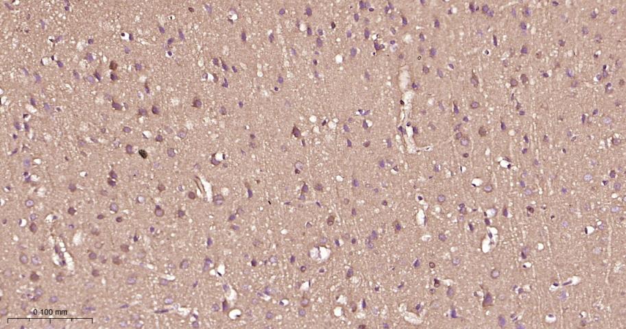 磷酸化雷帕霉素靶蛋白重组兔单抗