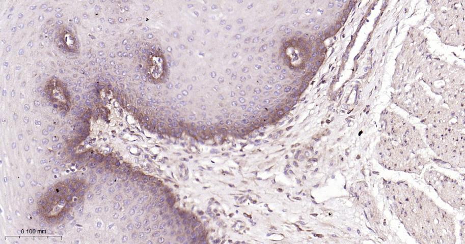 基质金属蛋白酶-14重组兔单抗