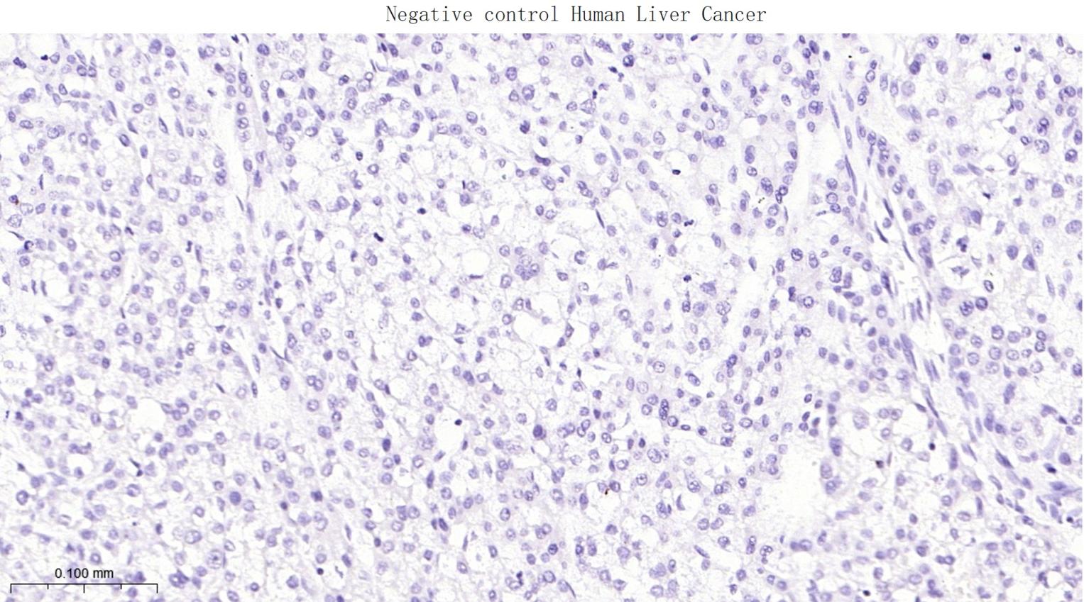 黑色素瘤相关抗原单克隆抗体-bsm-34121M