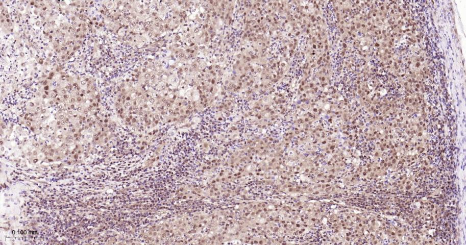 环指蛋白75重组兔单抗