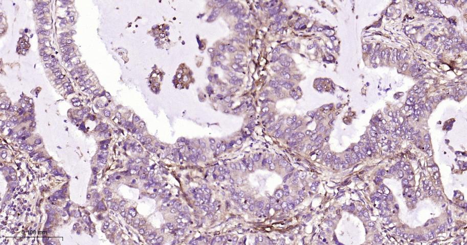 基质金属蛋白酶-14重组兔单抗