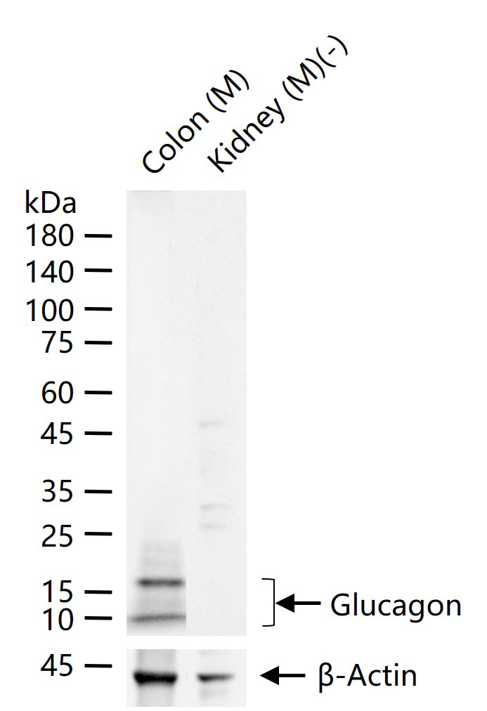 胰高血糖素重组兔单抗
