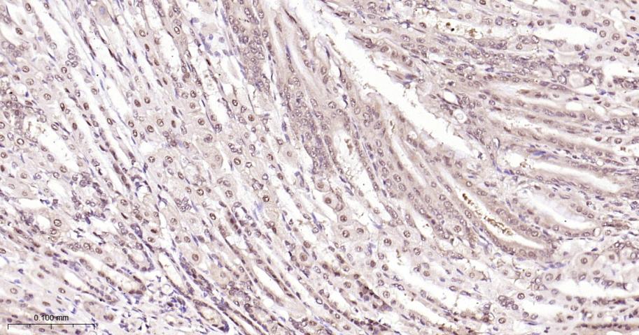 环指蛋白75重组兔单抗