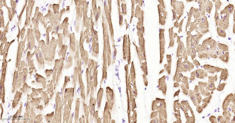 心肌肌钙蛋白重组兔单抗