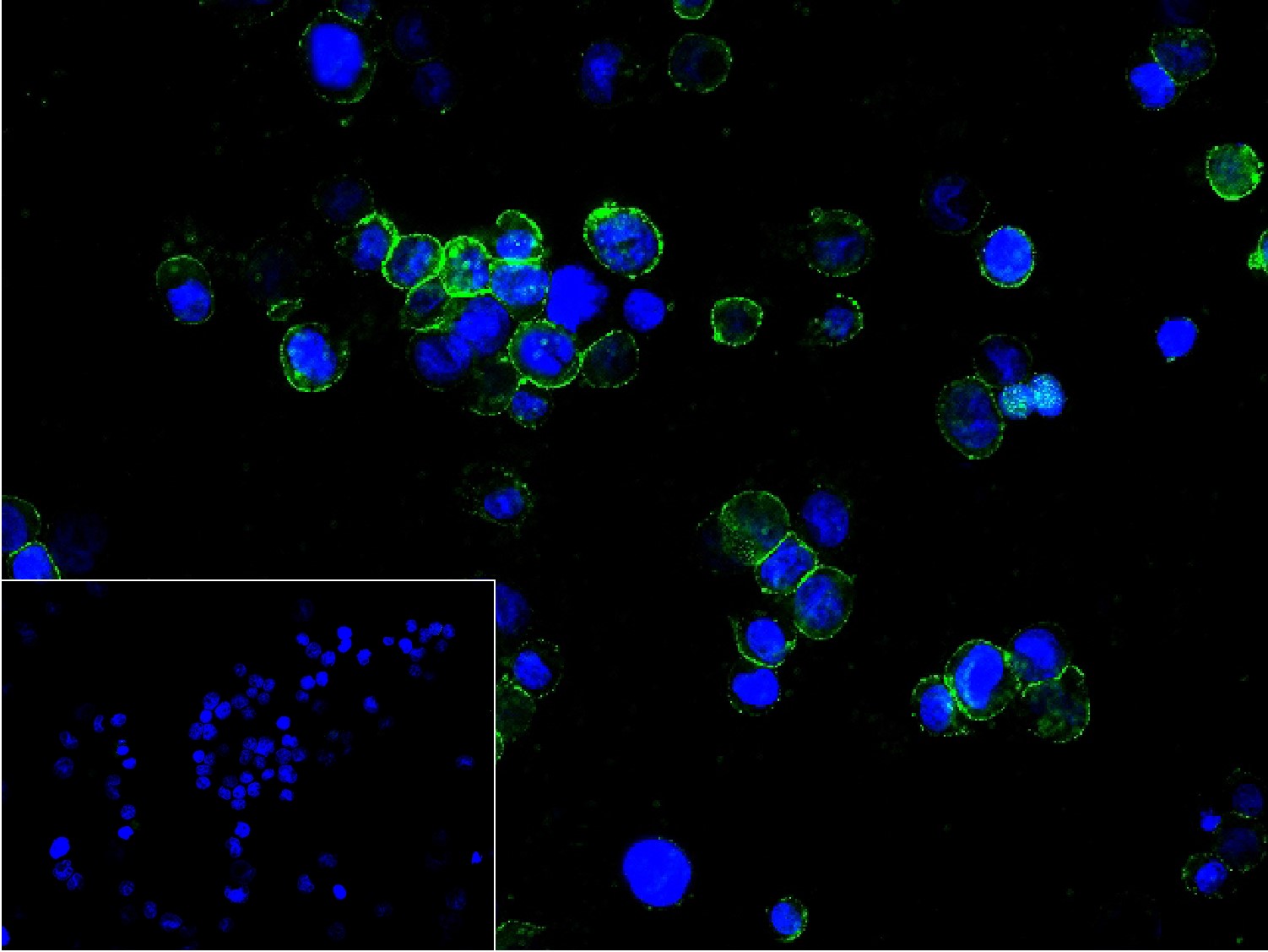 血小板内皮细胞黏附分子1单克隆抗体