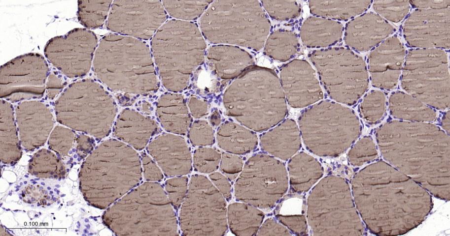 甲状腺球蛋白重组兔单抗-bsm-63331R