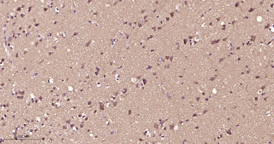 磷酸化雷帕霉素靶蛋白重组兔单抗
