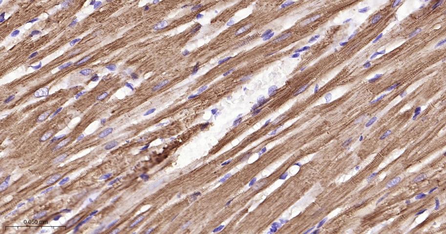 心肌肌钙蛋白重组兔单抗