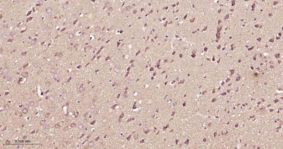 磷酸化雷帕霉素靶蛋白重组兔单抗