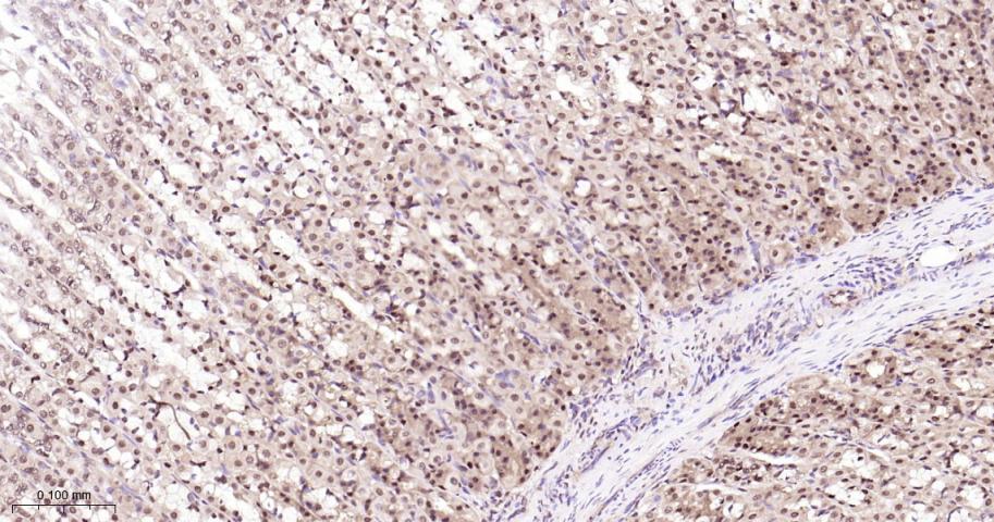 环指蛋白75重组兔单抗