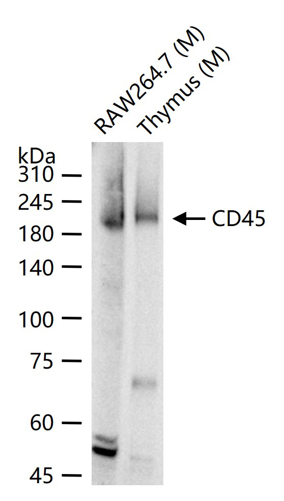CD45 Rabbit pAb (一抗) - WB,IHC-P,IHC-F,IF | Bioss