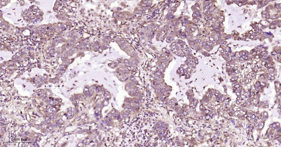 磷酸化雷帕霉素靶蛋白重组兔单抗
