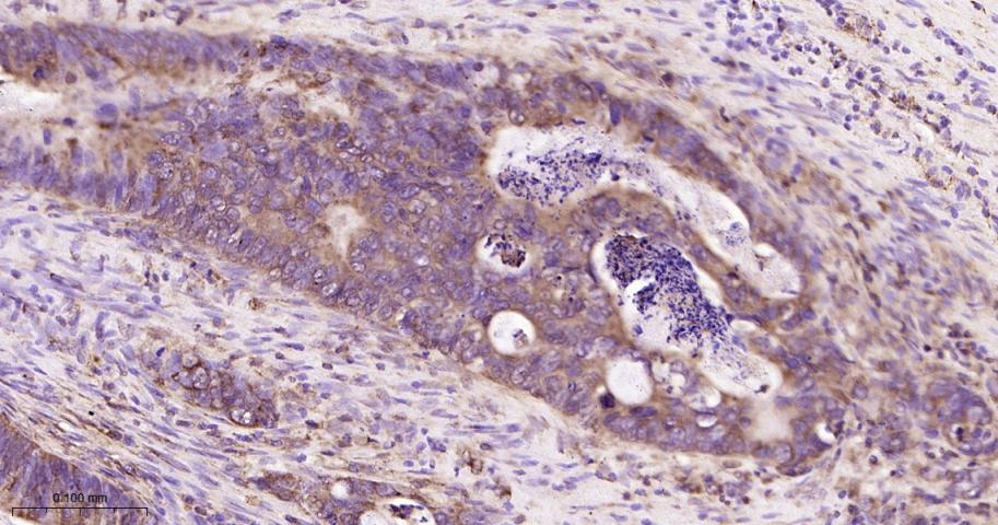 磷酸化雷帕霉素靶蛋白重组兔单抗