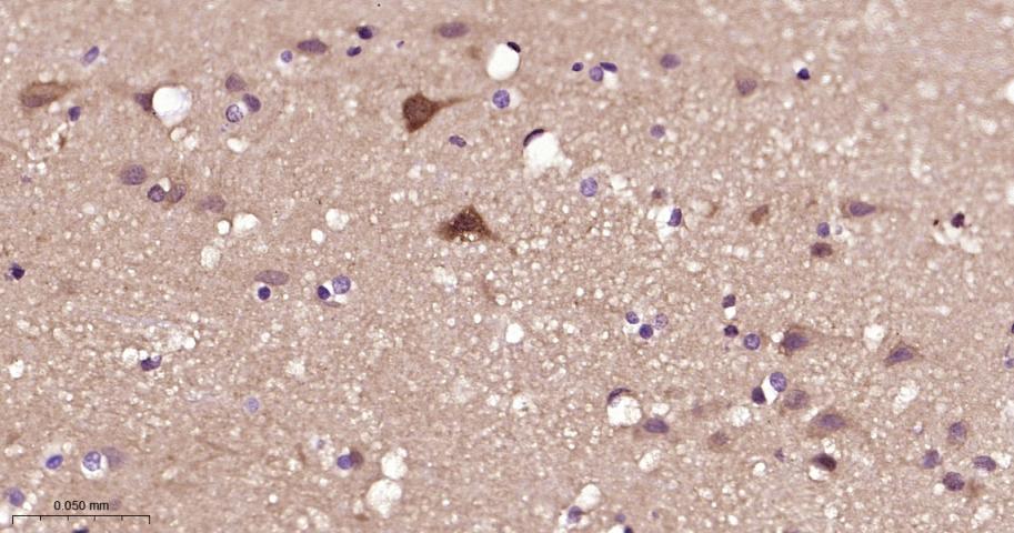 丝裂原活化蛋白激酶激酶1/2重组兔单抗