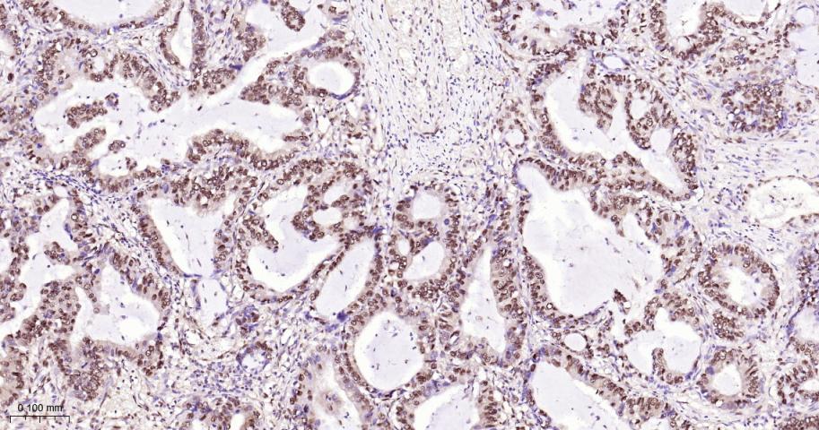 环指蛋白75重组兔单抗