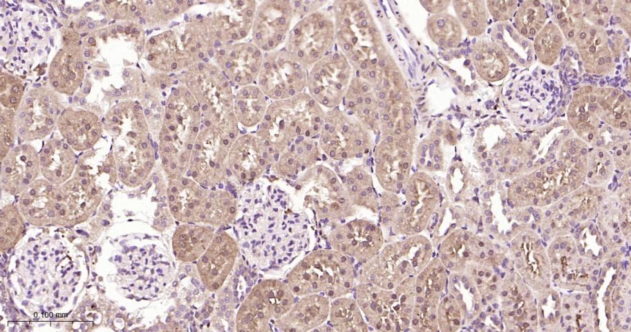 磷酸化雷帕霉素靶蛋白重组兔单抗