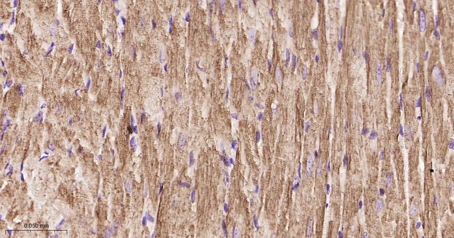 心肌肌钙蛋白重组兔单抗