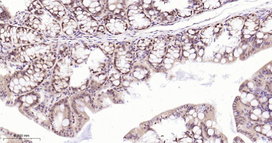 环指蛋白75重组兔单抗