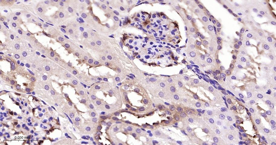 丝裂原活化蛋白激酶激酶1/2重组兔单抗