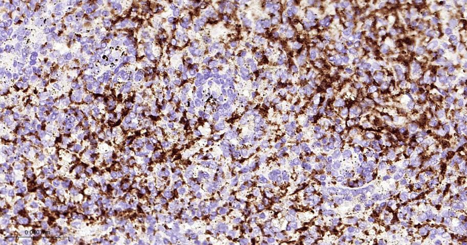 血小板膜糖蛋白Ⅱb(CD41)重组兔单抗