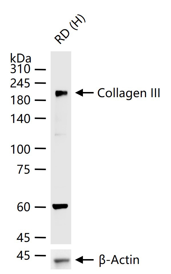 Collagen III Rabbit pAb (一抗) - WB,Flow-Cyt,ICC/IF | Bioss