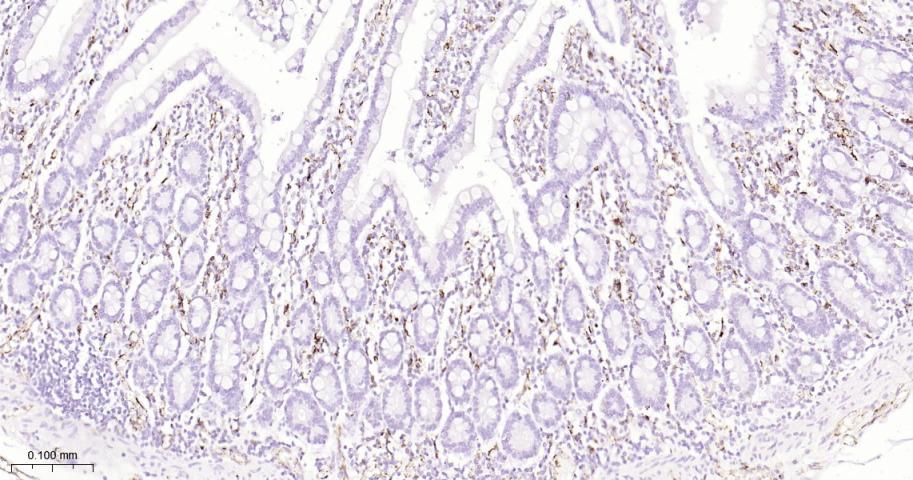 血小板内皮细胞黏附分子1单克隆抗体