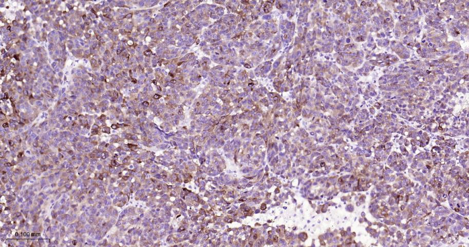 黑色素瘤相关抗原单克隆抗体-bsm-34121M