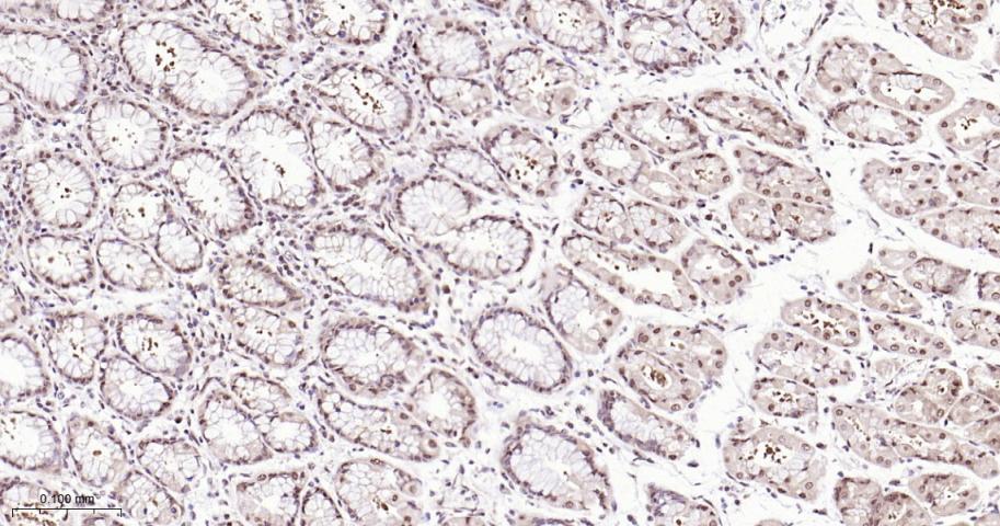 环指蛋白75重组兔单抗