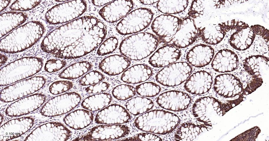 广谱细胞角蛋白PCK单克隆抗体