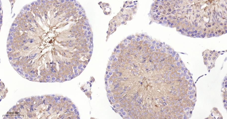 磷酸化蛋白激酶A α/β/γ重组兔单抗