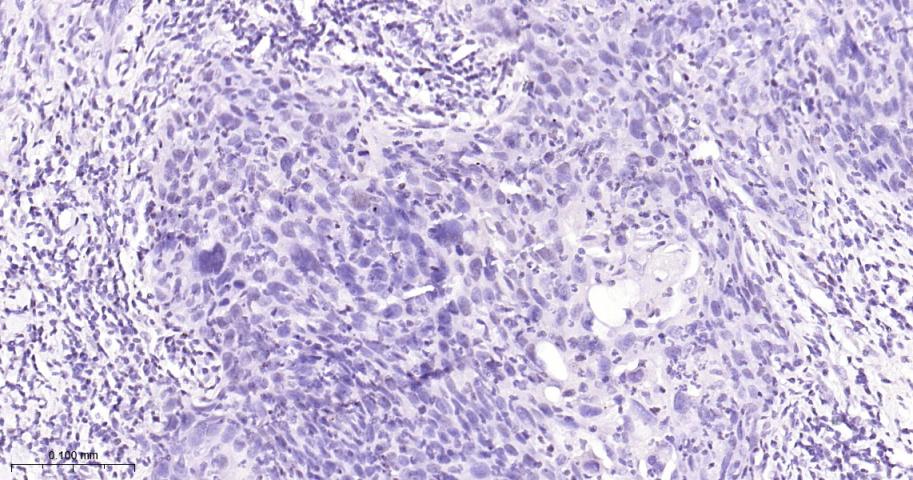 干扰素调节因子2重组兔单抗
